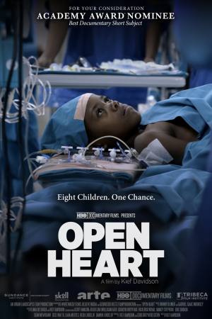 Open Heart