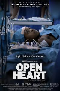 Open Heart